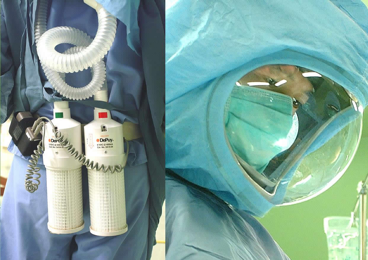 ステライルビューシステム